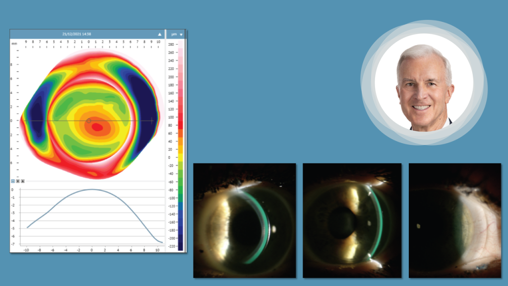 DirectConnect - From Image acquisition to Manufacturing in one step by Dr. Tom Arnold